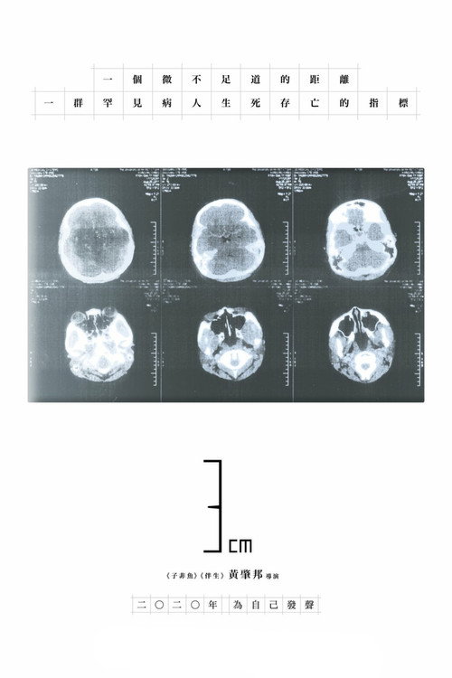 3CM