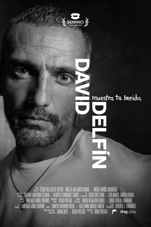 David Delfín. Muestra tu herida